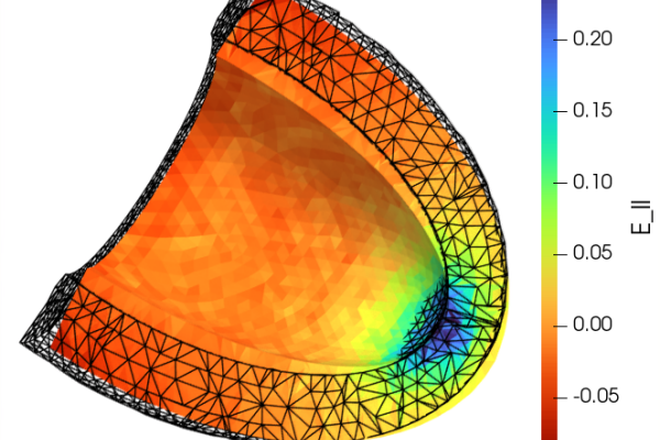 LV Longitudinal Strain Peak