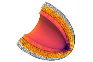 News Cardiac Imaging